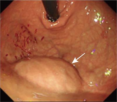 Case Report: Giant abdominal hemangioma originating from the liver